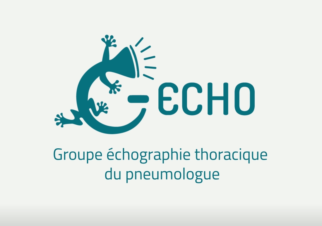 G-echo